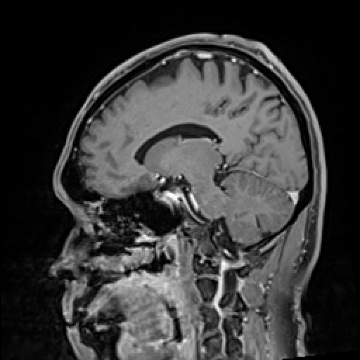 Click on the Serie image to view the images of VILLANUEVA, WILLIAM A.